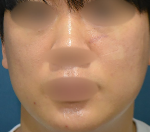 203248_9a2a4a9da9.png