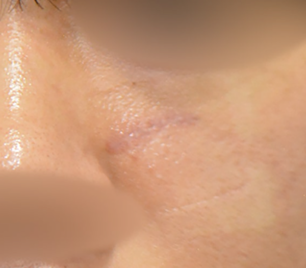 203306_c2f7a50e54.png
