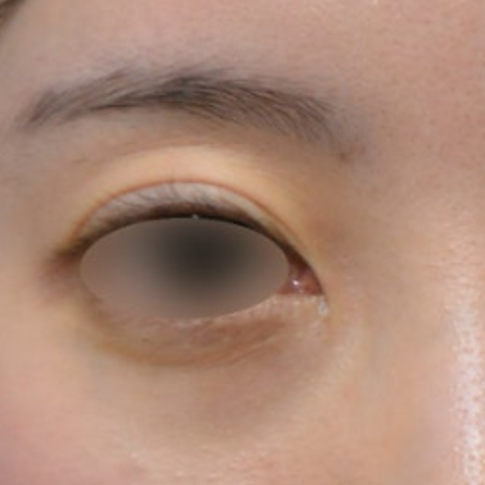 165416_404e6329ef.png